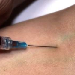 Hindari Komplikasi, Pasien Wajib Rutin Konsumsi Obat Hepatitis B