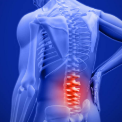 Jangan Takut, Kini Operasi Tulang Belakang Sangat Aman