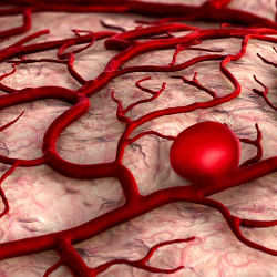 Penanganan Aneurisma Tanpa Pembedahan, Seperti Pasien di Hospital Playlist