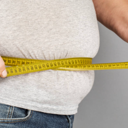 Penanganan Obesitas tidak Cukup dengan Mengurangi Asupan Kalori