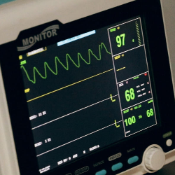 Penanganan Serangan Jantung Harus Cepat, Tepat, dan Cermat