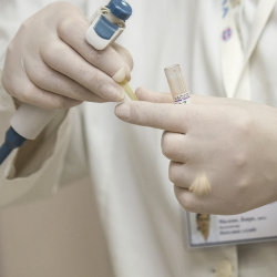 Setalah Hepatitis A Sampai E, Sekarang Muncul Hepatitis G