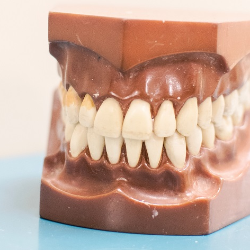 10 Penyakit ini Disebabkan oleh Kesehatan Mulut yang Buruk