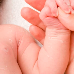 Ini Penyebab Sekaligus Cara mengatasi Kulit Kering dan Gatal pada Anak