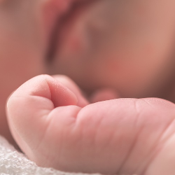 Penyebab dan Pengobatan Eksem pada Bayi