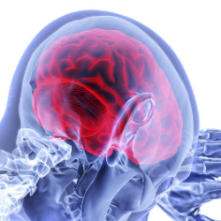 Penyebab, Gejala, dan Pengobatan Kanker Otak