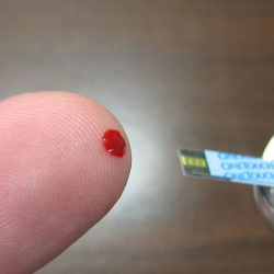 Awas, Ini Penyebab Gula Darah Tinggi di Malam Hari!