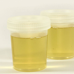 Penyebab Urine Berbusa, Bisa Jadi Tanda Kerusakan Ginjal