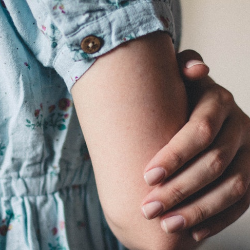 Hiperandrogen, Penyebab Rambut Tumbuh Abnormal pada Tubuh Wanita