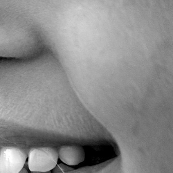 Pipi Bengkak, Ini Penyebab dan Cara Mengobatinya!