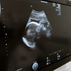 Mums, Yuk Ketahui Posisi-posisi Janin Menjelang Persalinan