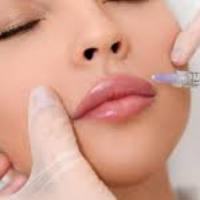 Prosedur Suntik Filler dan Botox, Aman Enggak Ya?