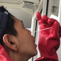 Prosedur Tes Swab Covid-19 dan Biayanya