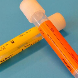 Ada Protein dalam Urine Ibu Hamil, Bahayakah?