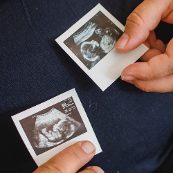 Risiko Kesehatan di Balik Program Bayi Tabung