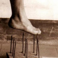 CIPA, Kondisi Tidak Merasakan Sakit Sama Sekali