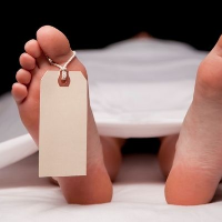 Bagaimana Sebenarnya Prosedur Autopsi Dilakukan?