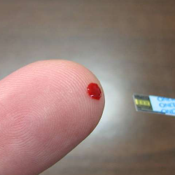 Ini Tanda-tanda Diabetes Semakin Parah!