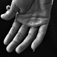 Telapak Tangan Berkeringat Pertanda Jantungan?