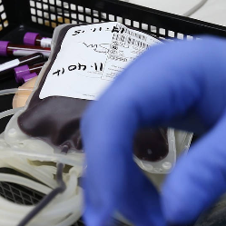 Terapi Anemia pada Penderita Gagal Ginjal Kronik