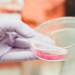 Stem Cell, Harapan Baru bagi Penderita Epilepsi