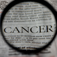 Tidak Hanya Kemoterapi, Ini Cara Lain Menangani Kanker