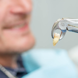 Tips Cabut Gigi Penderita Diabetes agar Aman