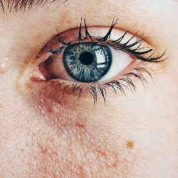 Punya Masalah dengan Pori-pori Besar? Lakukan Tips Berikut!