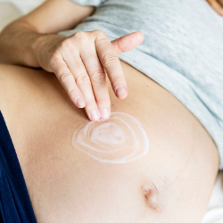 Muncul Stretch Mark saat Hamil? Berikut Tips Mengatasinya!
