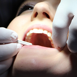 Bukan Hanya Gigi, Lakukan Ini untuk Menjaga Kesehatan Lidah!