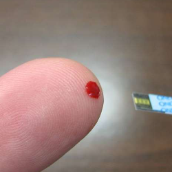 Tips Supaya Hasil Tes Gula Darah saat Hamil Akurat