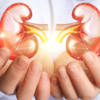 Keuntungan Transplantasi Ginjal Dibanding Hemodialisis