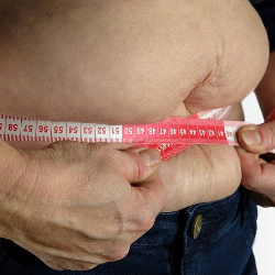 Bukan Obesitas Biasa, Ukuran Lingkar Pinggang Memicu Diabetes