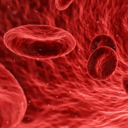 Waspada Terkena Anemia Aplastik