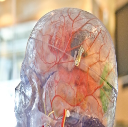 Kenali Tubuhmu Sendiri Melalui Tes Berikut!