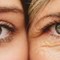 Yuk Kenali Tanda –tanda Penuaan pada Mata