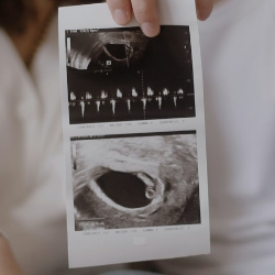 Pentingnya Konsumsi Zat Besi untuk Program Hamil